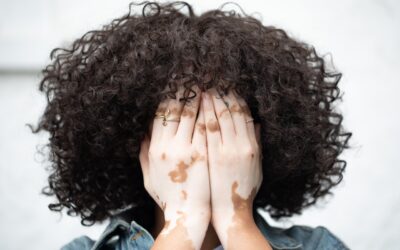 7 Proven Ways to Reduce Anxiety Attacks